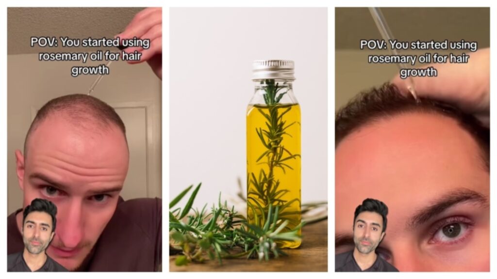 Looking for hair growth solution? Try rosemary oil; doctor reveals this simple herb oil is the go-to for thicker hair | Health