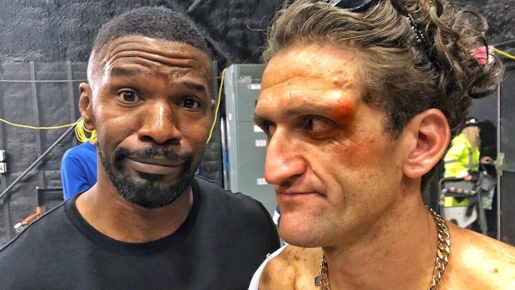 JAMIE FOXX GAVE ME A BLACK EYE