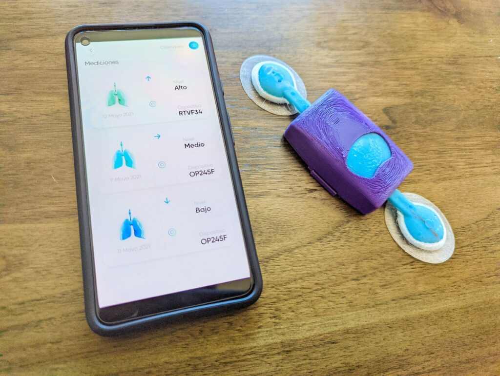 Lung-health startup Respira Labs inhales .8M to help respiration patients breathe easier