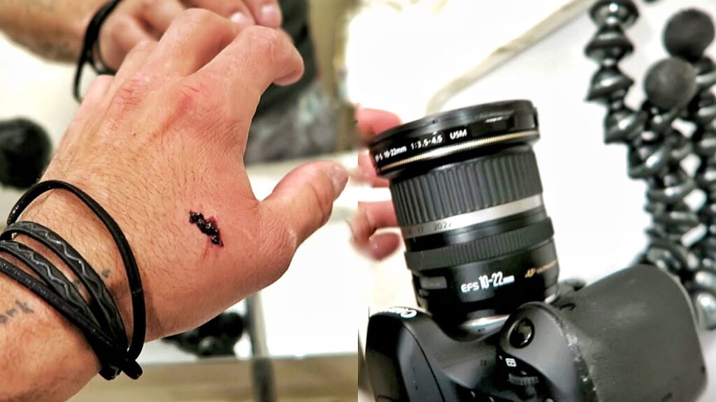 broke my camera, broke my hand