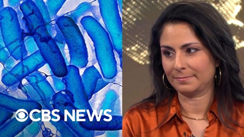 Doctor on E. coli outbreaks, whooping cough, bird flu and mpox