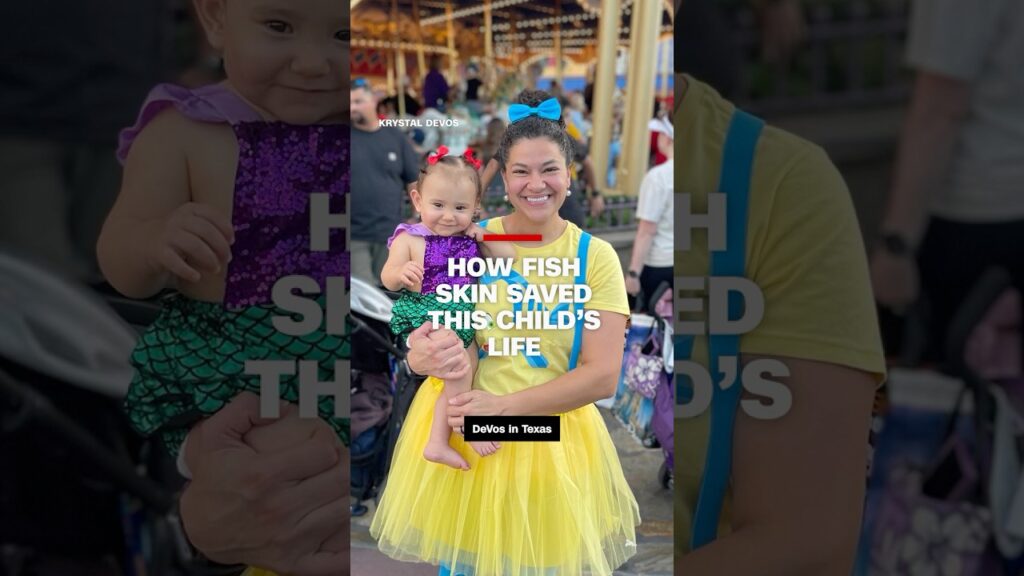 How fish skin saved this child’s life