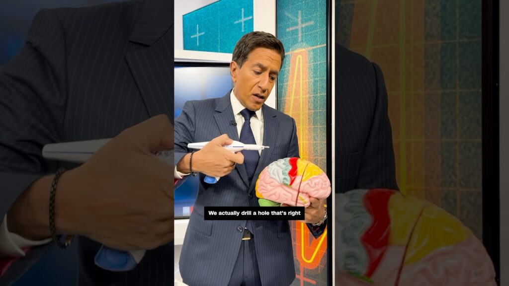 Dr. Sanjay Gupta demonstrates shunt procedure that might treat Billy Joel’s neurological disorder