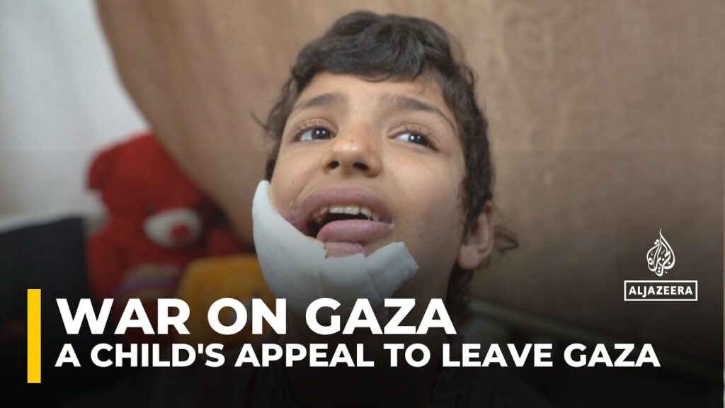 Israel denies child’s medical evacuation: Military air strike blew off part of Mazyouna’s face