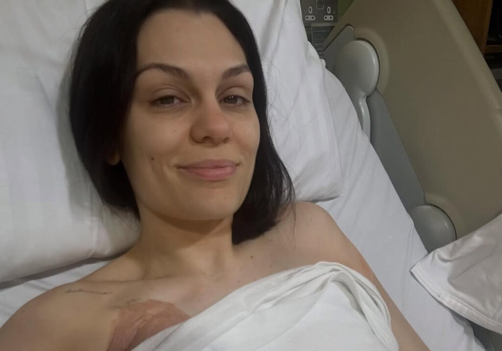 Jessie J Cancer Update: It’s Not Looking Good As Artist To Undergo Second Breast Surgery