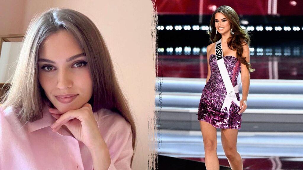 Russian model dies weeks after elk crashes through car windshield on highway