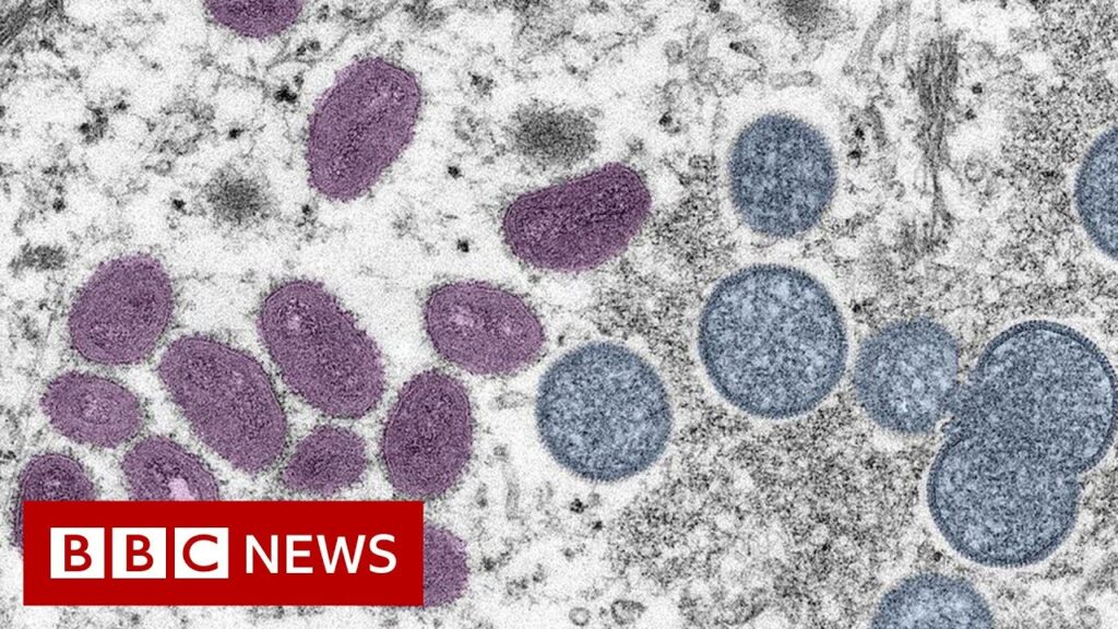 First monkeypox deaths reported outside Africa – BBC News
