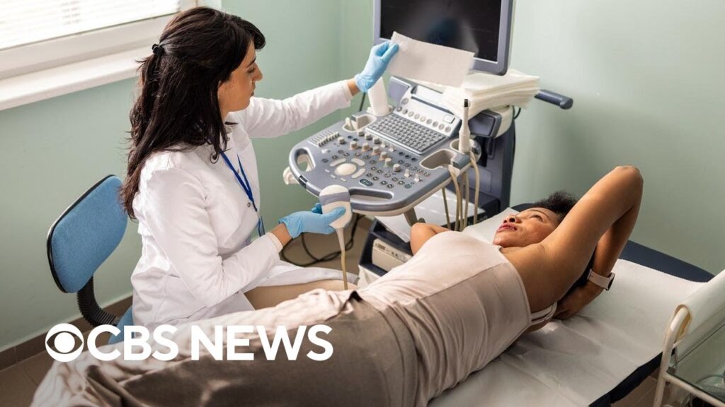 Black women 40% more likely to die from breast cancer than white women, study finds