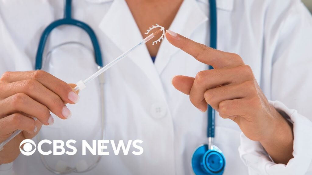 New pain management guidelines for IUD procedures from CDC