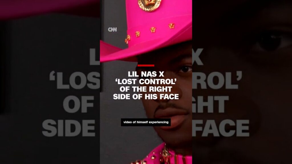 Lil Nas X ‘lost control’ of the right side of his face